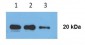 Anti-human CD81 antibody